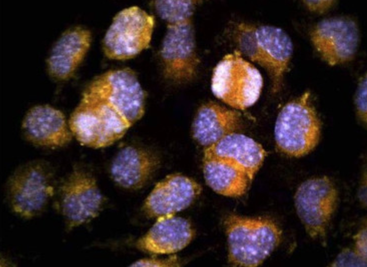 Лишайники и водоросли могут стать первыми формами жизни, которые мы найдём экзопланетах, похожих на Землю.