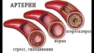 Каждый орган и каждая ткань тела нуждаются в притоке свежей, богатой кислородом крови. Эта кровь доставляется во все части тела через кровеносные сосуды, называемые артериями.