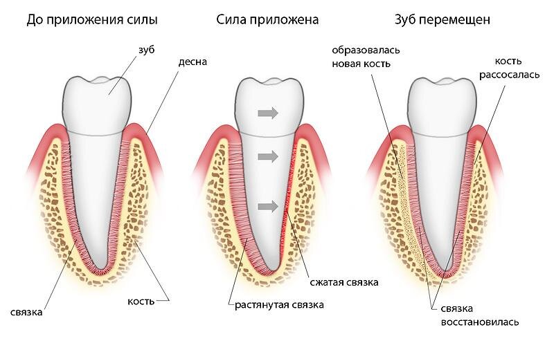 Причины ломящей боли всех зубов | Стоматологическая клиника VIVADENT