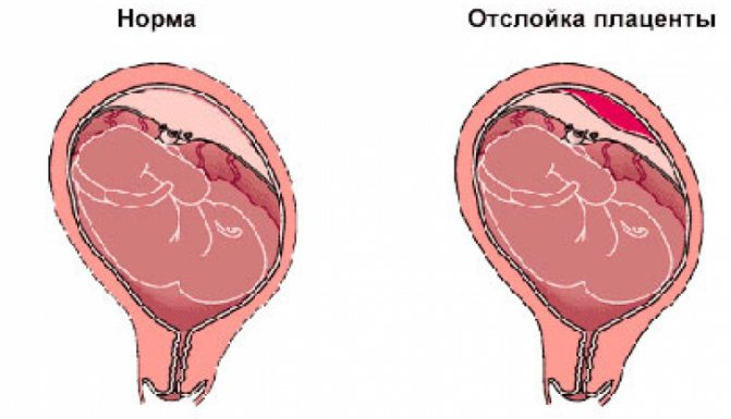 Гематома и секс