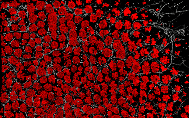   Эпителий кишечника: бокаловидные клетки (красные) и нейроны (серые)/ © Harvard Medical School
