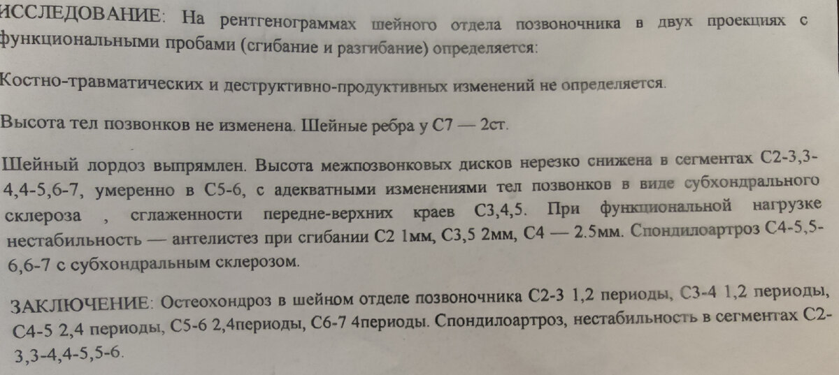 Шейный остеохондроз — 26 ответов | форум Babyblog