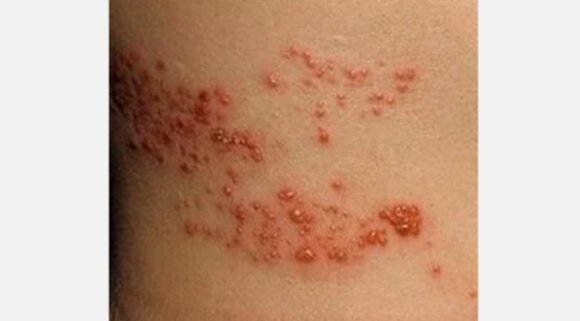 Фото взято из яндекс картинки