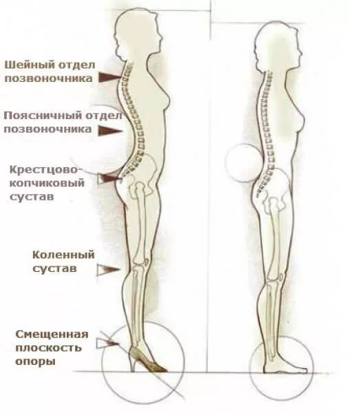 Красота требует жертв, или оно того не стоит? О вреде высоких каблуков