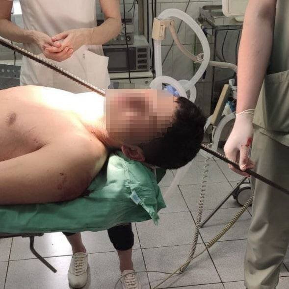 💀В Москве парень на стройке упал с высоты второго этажа и головой насадился на 1.5-метровую арматуру. 

Врачи провели операцию и молодой человек выжил.

🤙🏻Dead News