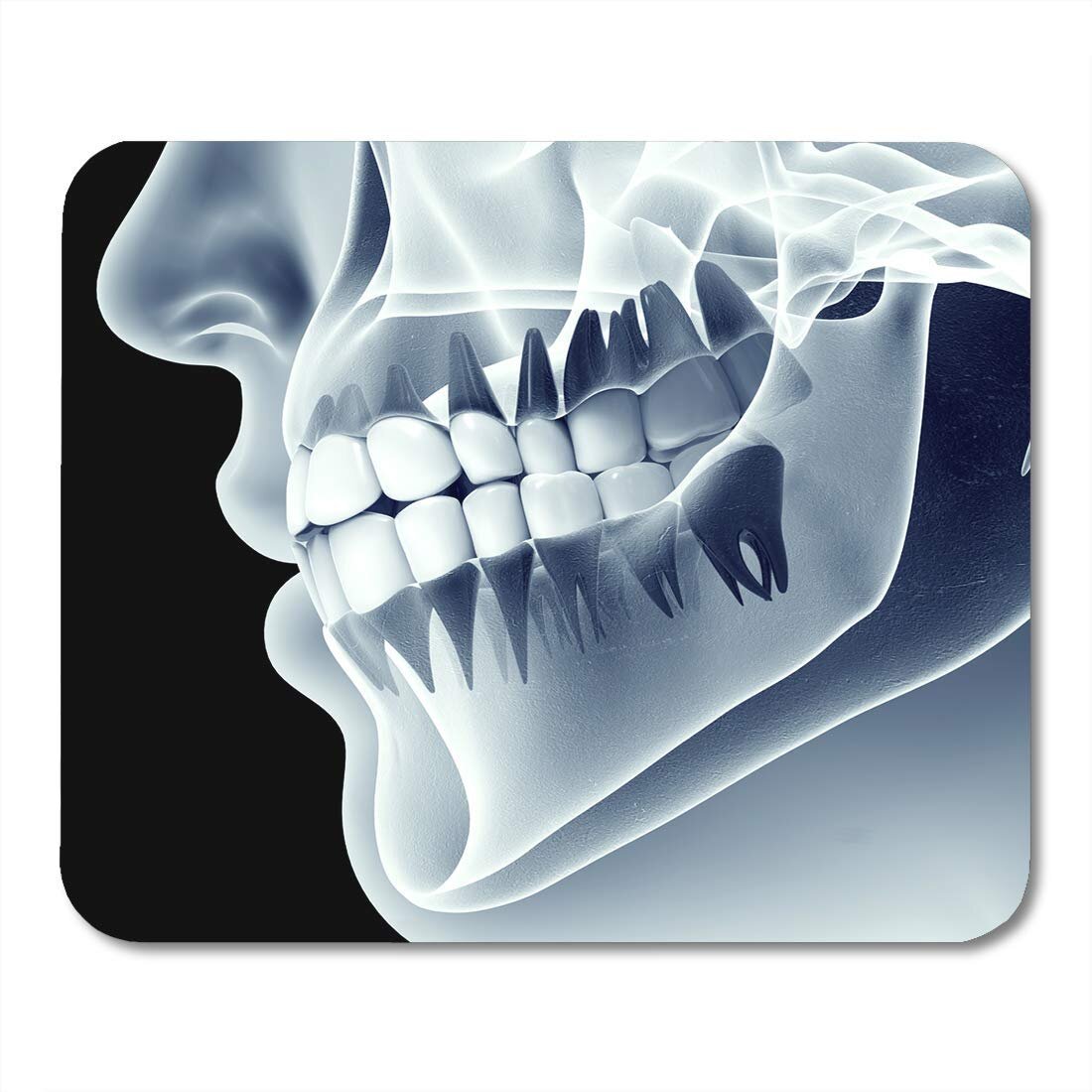 Зачем стоматологи просят переделать заново рентгеновские снимки