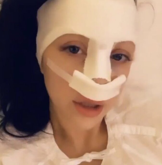 Алена после операции 