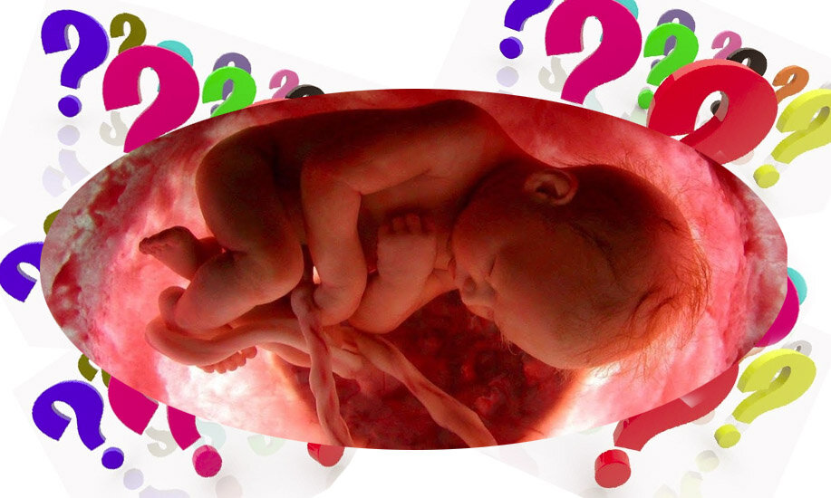 Рисунок автора 