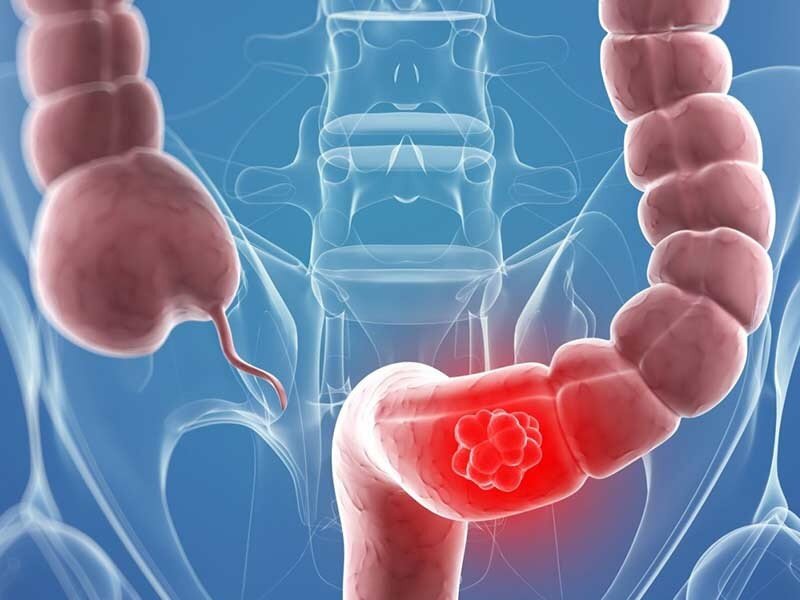 photo: gastroenterologoscr.com