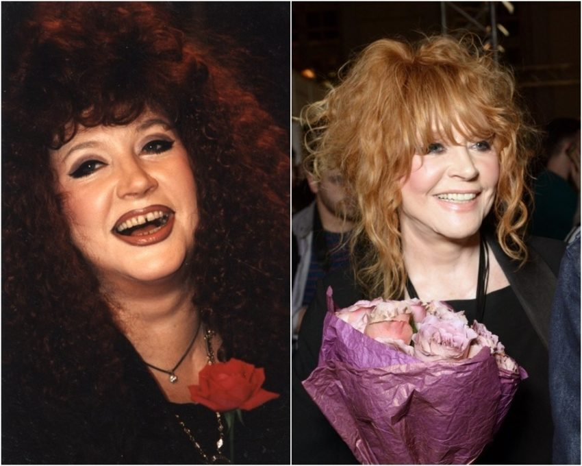 Алла Пугачёва и Таисия Повалий: зубы за 100 тыс. €, фото до-после | Портал  о зубах Симпладент | Дзен