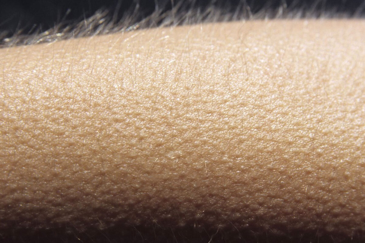 Так выглядит фриссон