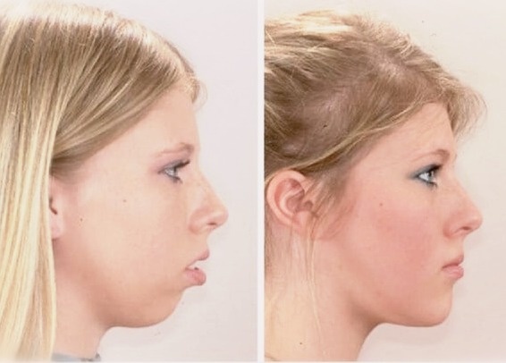 Красота, внешность, лицо, молодость