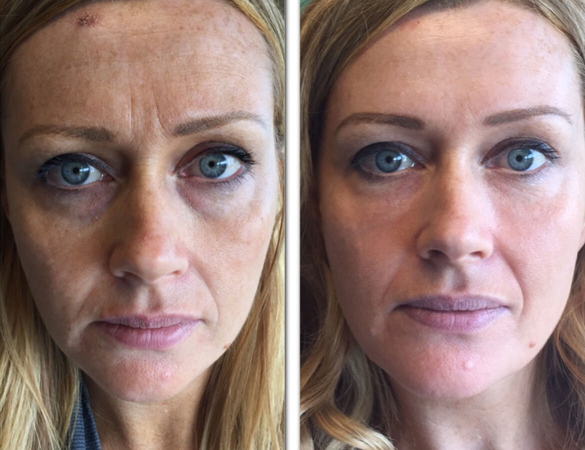 Молодость. Красота. Женщины. Полезный рецепт омоложения. Домашняя косметика.