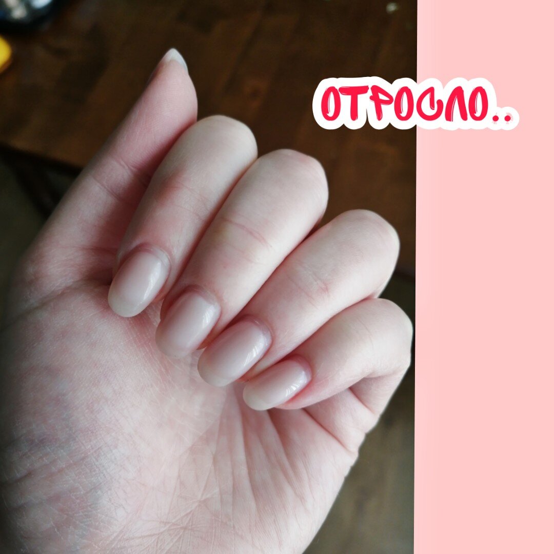 Вот мой отросший маникюр