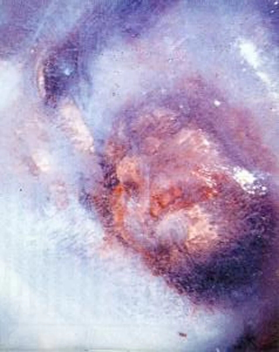 Лицо вмороженного йети