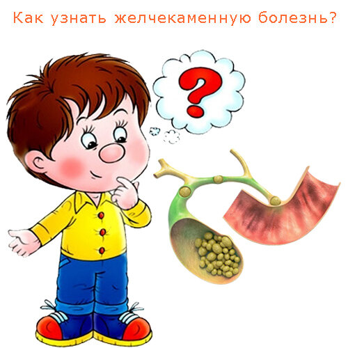 Как узнать желчекаменную болезнь?