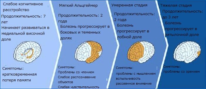 [caption id="attachment_1095" align="aligncenter" width="655"] Какие стадии бывают[/caption]