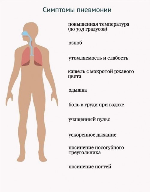 Пневмония. Она может наблюдаться как во время недуга, так и уже после выздоровления спустя пару суток. Ослабленная иммунная система просто не может справиться с целой армией микробов верхних дыхательных путей. Если пневмония является осложнением после гриппа, симптомами будут сильно высокая температура, болезненность и чувство сдавливания в грудной клетке, одышка. Как только недуг начнет набирать свои обороты, то без госпитализации уже не обойтись. Потребуется круглосуточная терапия и регулярное наблюдение врача.
