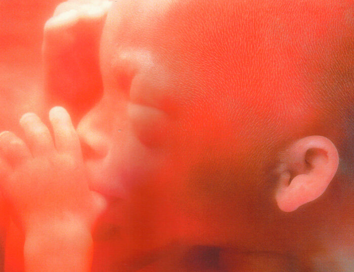 Источник фото: Яндекс Картинки