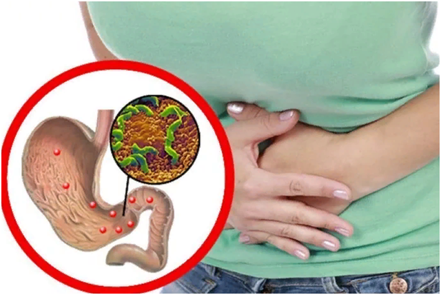 Хеликобактер пилори (Helicobacter pylori) – чрезвычайно вредоносные микроорганизмы, вызывающие гастрит, язву желудка и двенадцатиперстной кишки.