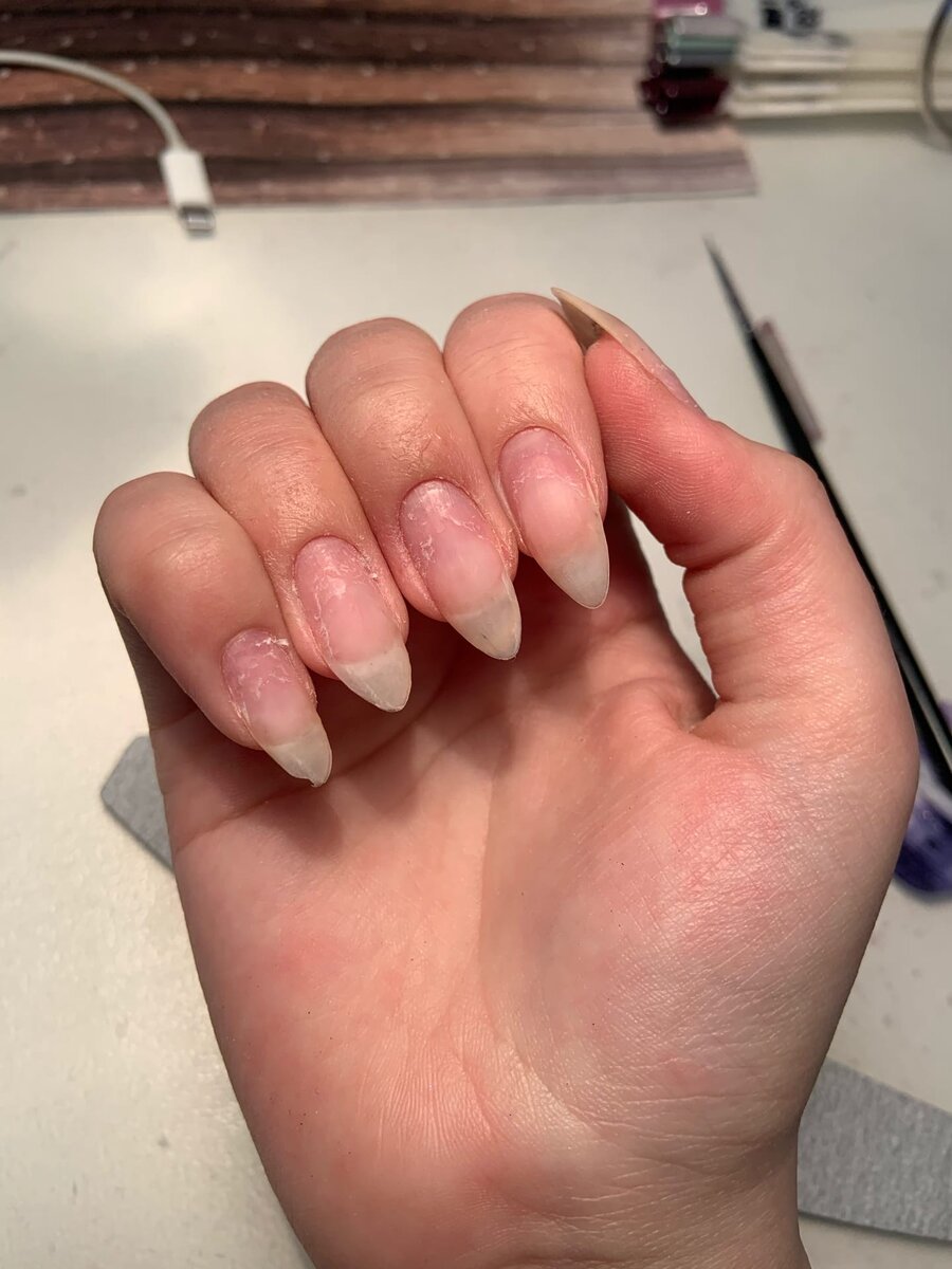 Фото моих ногтей после беспрерывного покрытия на протяжении 2 лет, укрепляю гелем