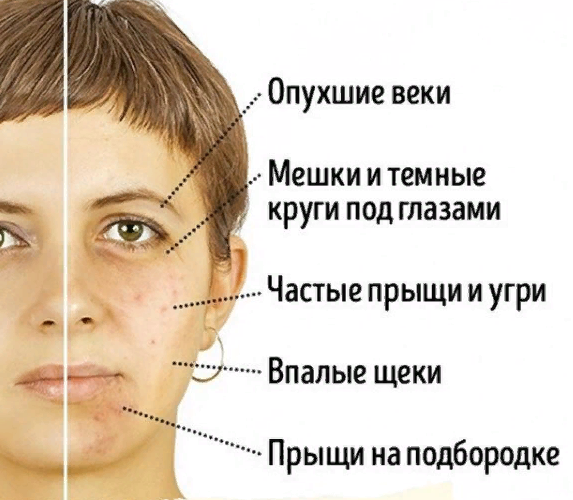 Воспаление соска – симптомы, причины и лечение телита | «Будь Здоров»