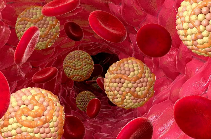 Холестерин в крови 