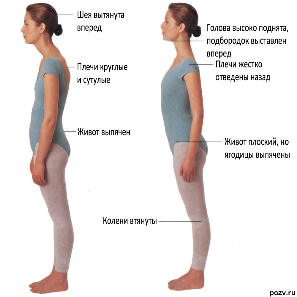 1-Плохая осанка                                                                            2-Хорошая осанка