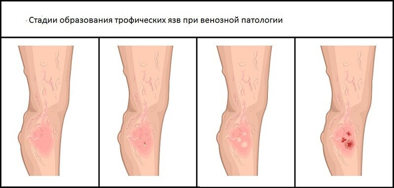 Из открытых источников