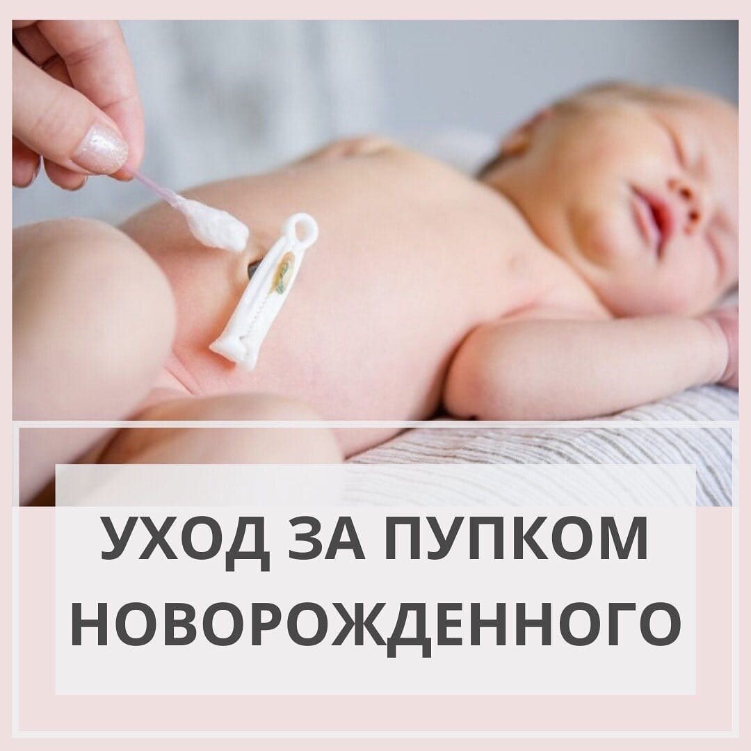 Клинические рекомендации по уходу за пупком новорожденного