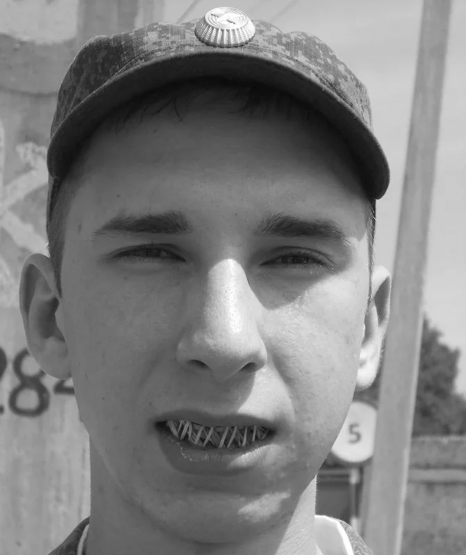 В армии можно служить с брекетами. Фото: Яндекс.Дзен