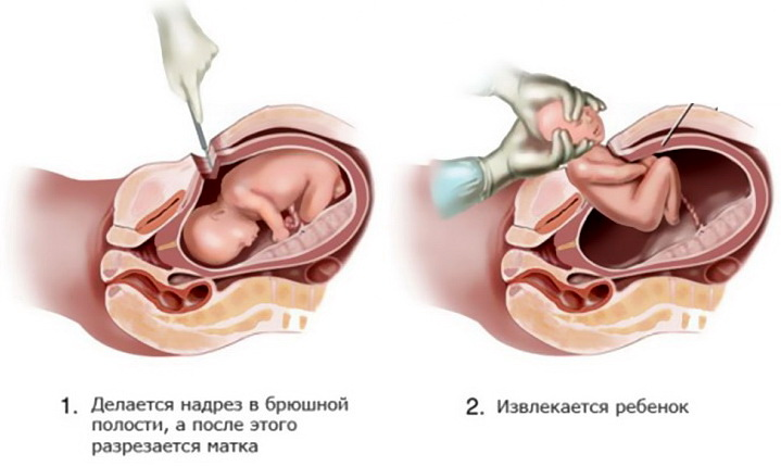 Источник фото - Яндекс картинки
