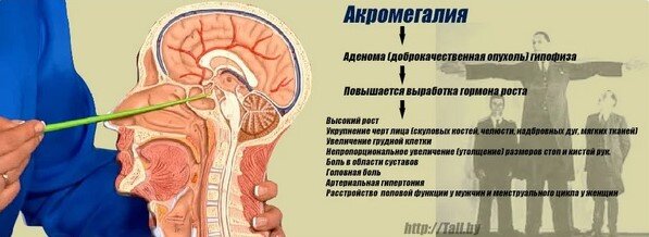 За обеими историями скрывалась одна и та же неизлечимая и тяжёлая болезнь