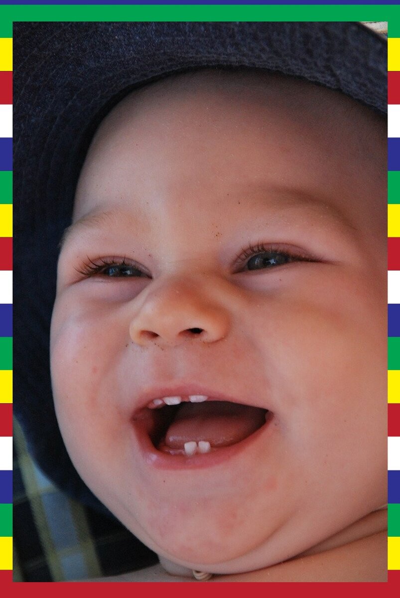 Как облегчить ребенку состояние?