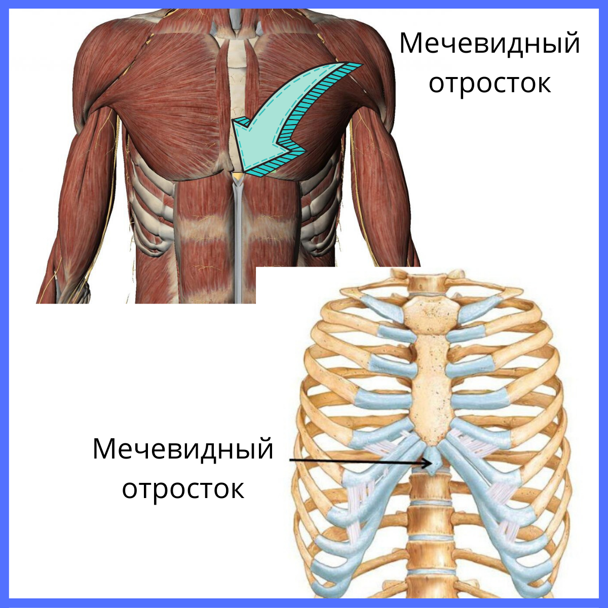 Мечевидный отросток картинка