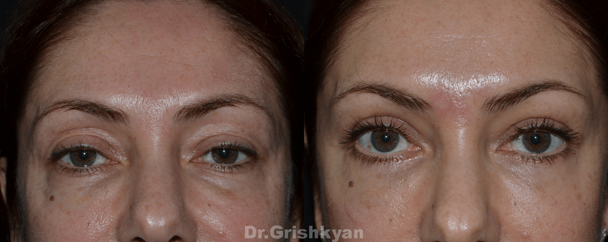 Фото с сайта Д.Р. Гришкяна. Имеются противопоказания, требуется консультация специалиста