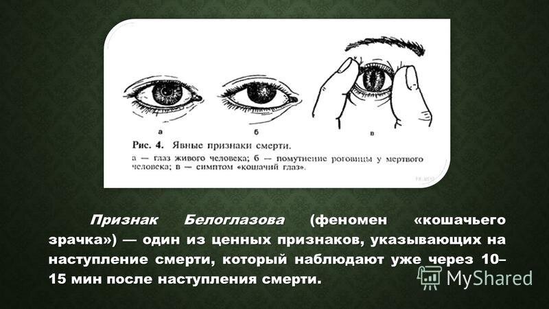 Как выглядит смерть глазами человека