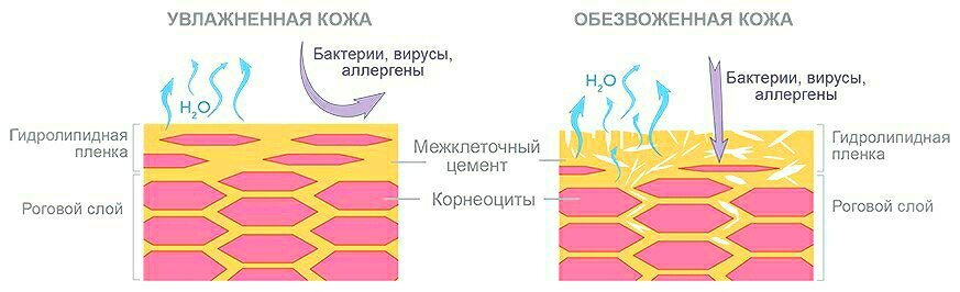 Как напитать кожу влагой. Натуральный увлажняющий фактор кожи схема. Натуральный увлажняющий фактор эпидермиса это. Гидролипидный слой кожи схема. Обезвоженная кожа схема.