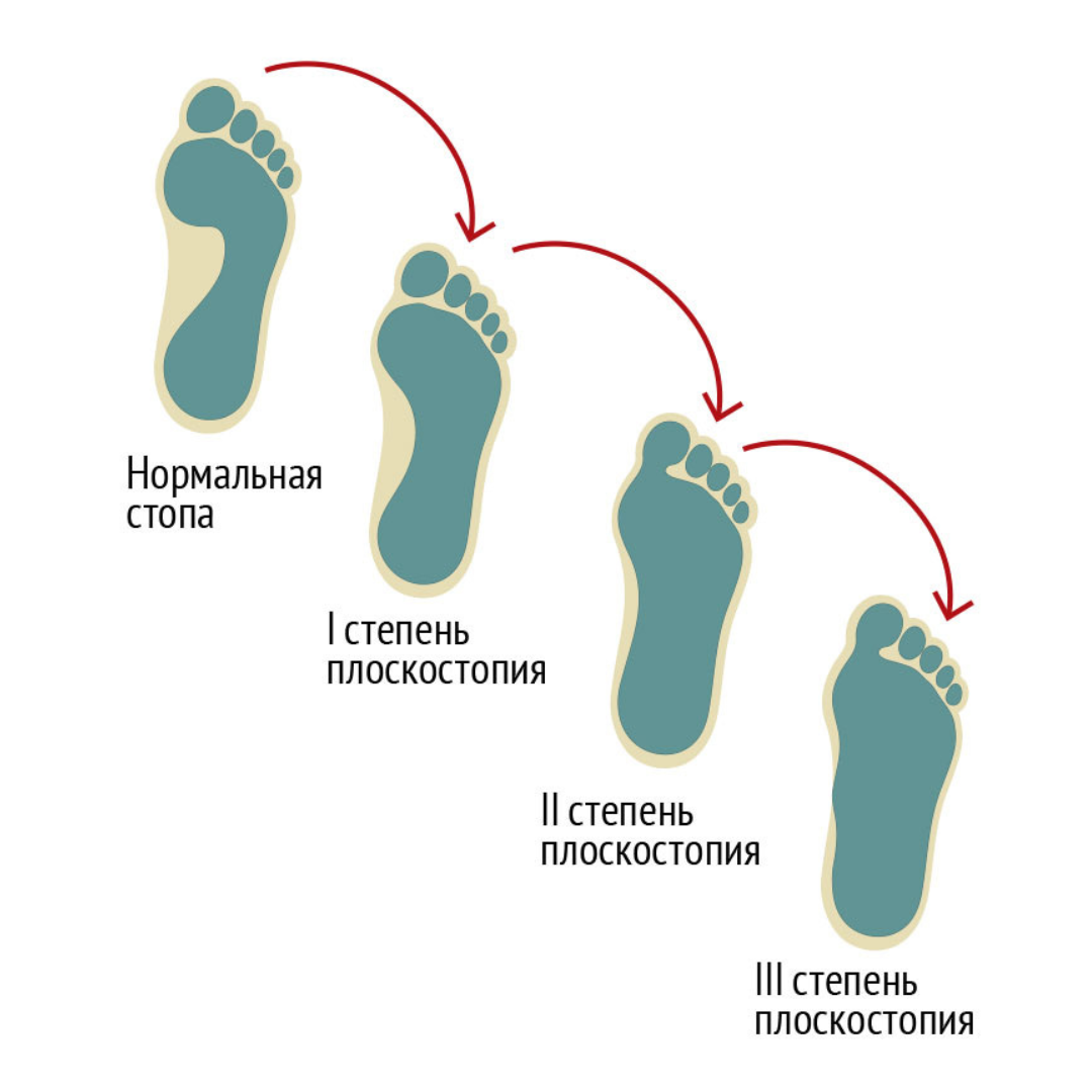 Таблетки от варикоза: какие выбрать и стоит ли? - Klinik.by