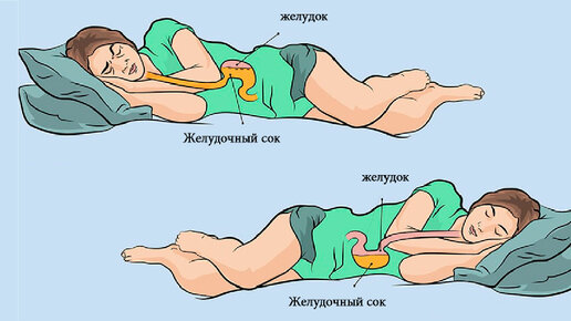 Как спать беременным