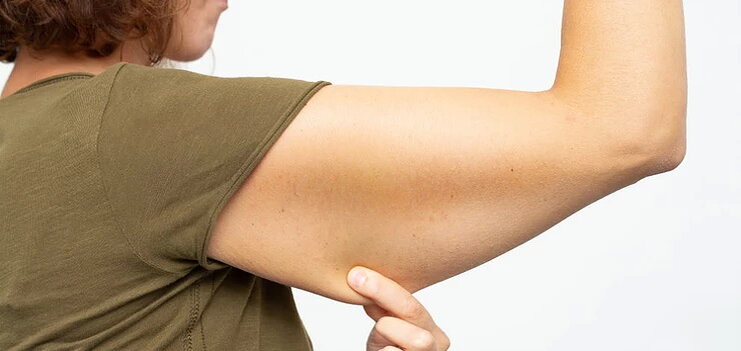 Саркопения