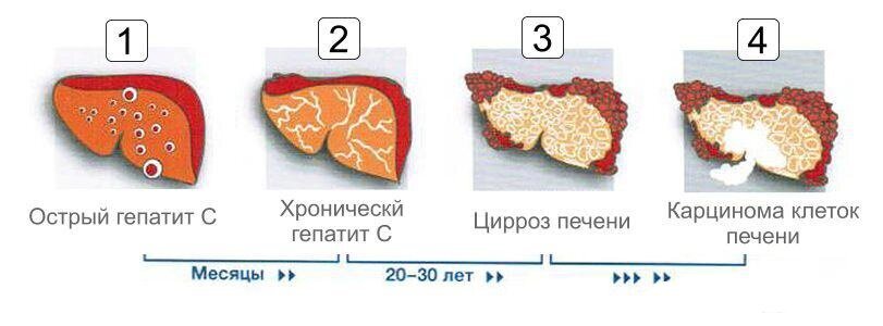 Разыскивается ласковый убийца