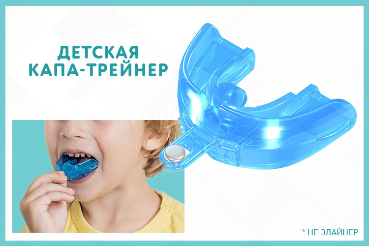 Капы и элайнеры – разные вещи или одно и то же? | Стоматология Smile-at ...