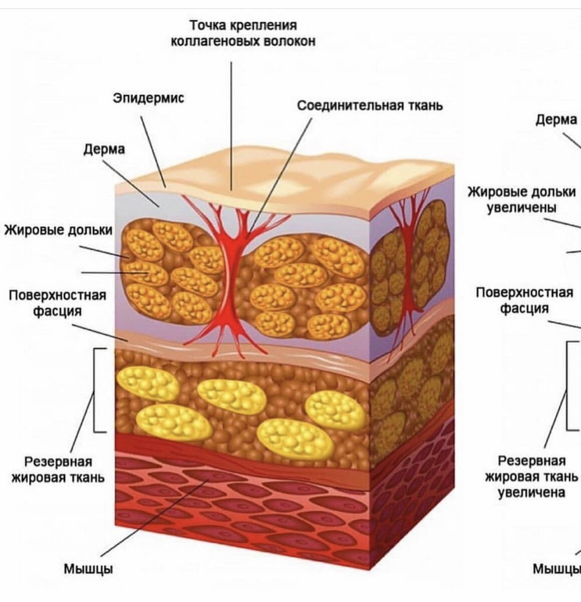 Фиброзные жировые изменения. Подкожно-жировая клетчатка (гиподерма). Строение кожи подкожная жировая клетчатка гиподерма. Гиподерма это подкожная жировая клетчатка. Строение подкожно жировой клетчатки.