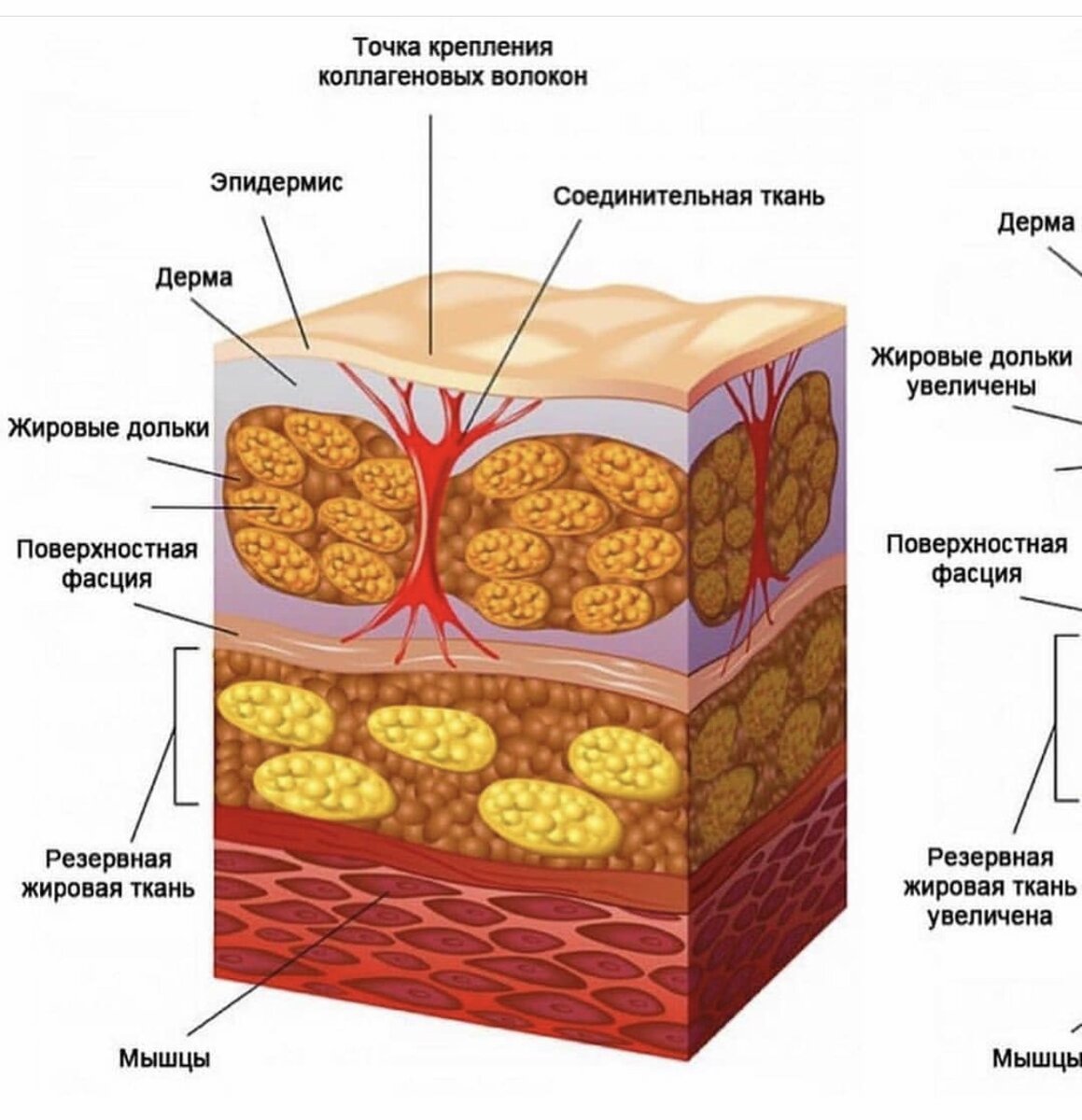 Подкожно жировая клетчатка картинка