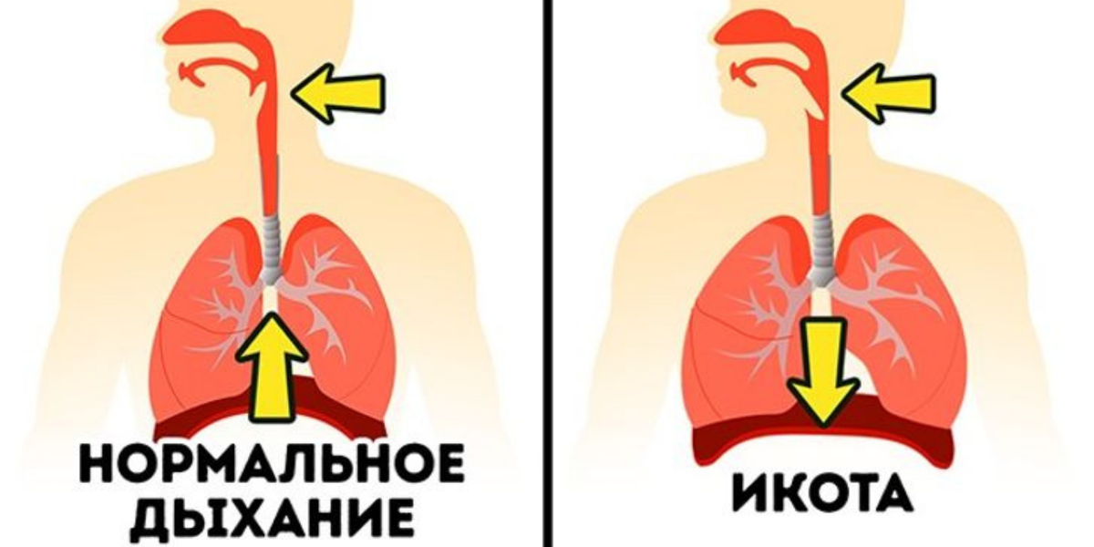 Как можно избавиться от икоты. Отчего икота. Почему человек икает. От чего возникает икание. Человек икает причины.