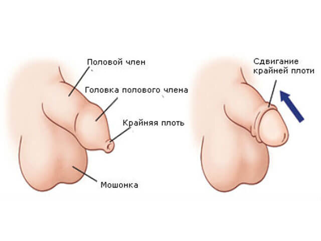 Размер полового члена. Что такое Размер полового члена?