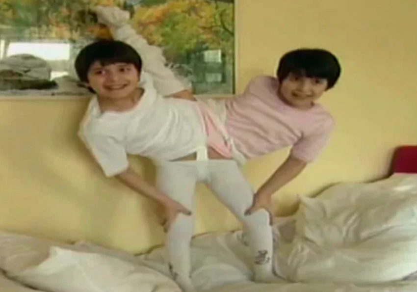 Зита и гита сиамские близнецы. Зита и гита сиамские близнецы. Зита и гита сиамские близнецы история. Зита и гита резахановы. Зита и гита резахановы.