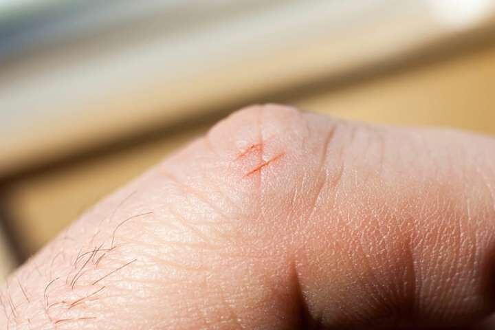 Порезы от бумаги намного болезненнее обычных. Источник изображения:  shutterstock.com
