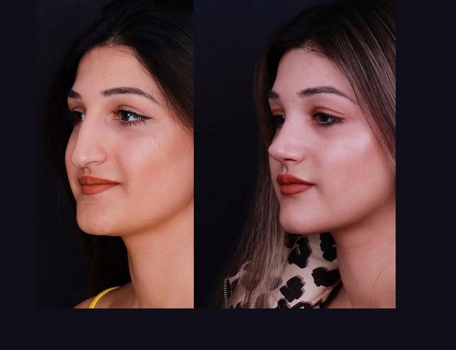 фото: @op.dr.turgutyuce